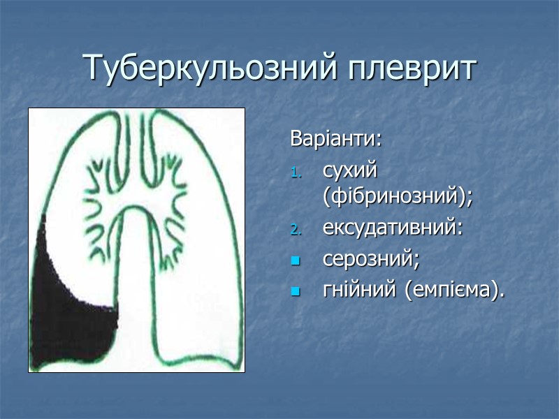 Туберкульозний плеврит Варіанти: сухий (фібринозний); ексудативний: серозний; гнійний (емпієма).
